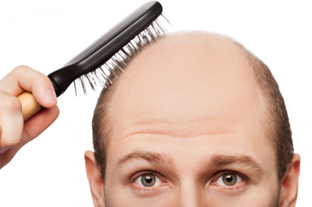 Best hair transplantation in India